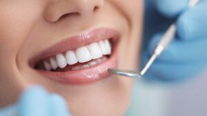 Child receiving a dental sealant while a caregiver watches in a bright dental exam room.